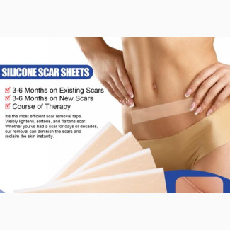 Silicon Scar Removal Sheet/ Tape