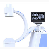 High Frequency Mobile C-arm