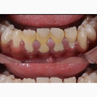 Dental Clinic in Alimosho (Abule Egba/Meiran/Kola/Alagbado)