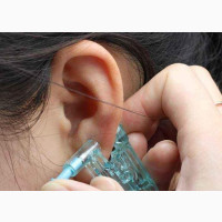 Nose and Ear Piercing Kit