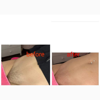 Under Arm Wax