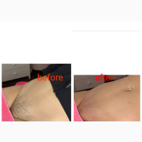 Under Arm Wax