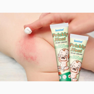 Prickly Heat Relief Cream For Babies