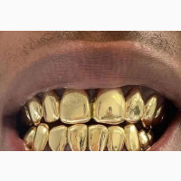 Available in Affordable Prices