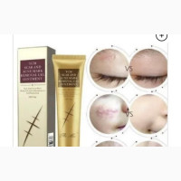 Pei Mei TCM Scar, Stretch Marks and Acne Removal Gel