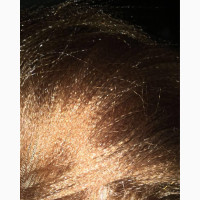 360 Full Lace Wig Attachment, Use for Braided Wigs