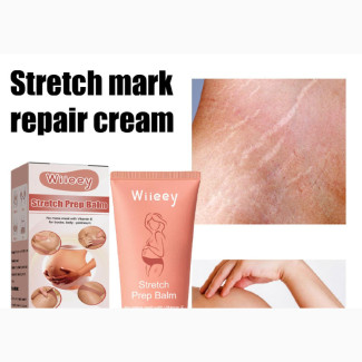 Postpartum Stretch Mark Repair Cream