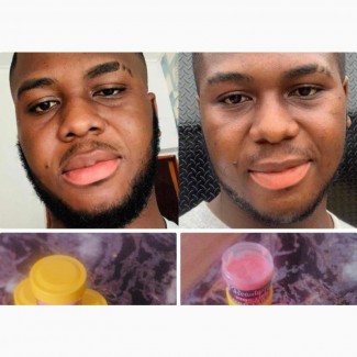 Fresh Pink Lips Balm ( No Side Effects )