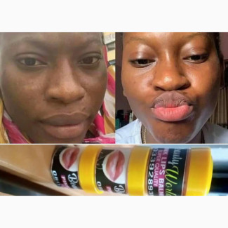 Pink Lips Balm - No Side Effects, Highly Effective