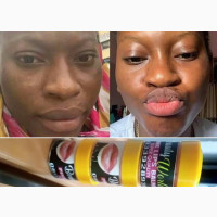 Pink Lips Balm - No Side Effects, Highly Effective