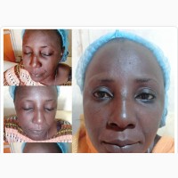 Facial Treatment