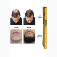 Reebonn Rapid Fast Hair Beard Growth