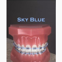 Fashion Braces Available