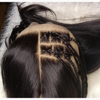 Hair Ventilators URGENTLY Needed