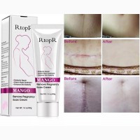 Rtopr Mango Stretch Marks Solution