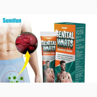 Genital Warts Remover Cream