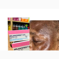 Melanofree