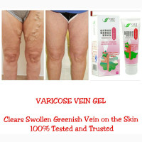 Varicose Vein Eraser Gel