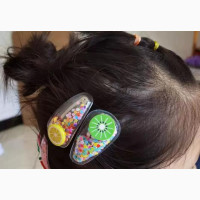 Beautiful Fruit Design Hair Clip For Girls