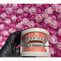 Blue Fashion Braces