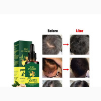 7 Days Ginger Germinal Hair Growth