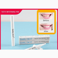 Get a Brighter Smile with Smile KIT Teeth Whitening Pen