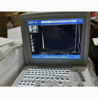 Xf300 Full Digital Ultrasound - Portable and Easy to Use