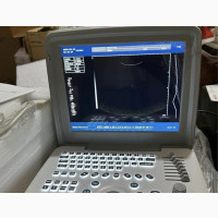 Xf300 Full Digital Ultrasound - Portable and Easy to Use