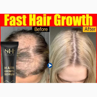 Fast Hair Growth Solution