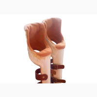 Knee-Ankle-Foot Orthosis for Genu Recurvatum Deformity