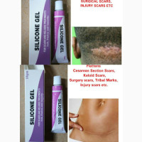 UDL Union Silicone Gel Flattener (Scar/Keloid/Bumps/Wound)