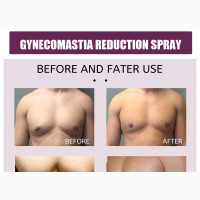 Gynecomastia (Men Chest) Firming Spra