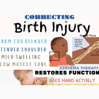 CORRECTING BIRTH Injury-Muscle and Nerve Rehabilitation