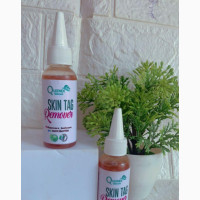 Skin Tag Remover Oil in Ibadan